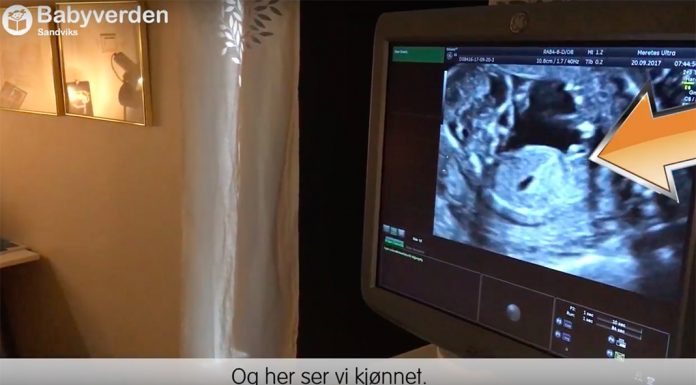 lesbiske føtter pics